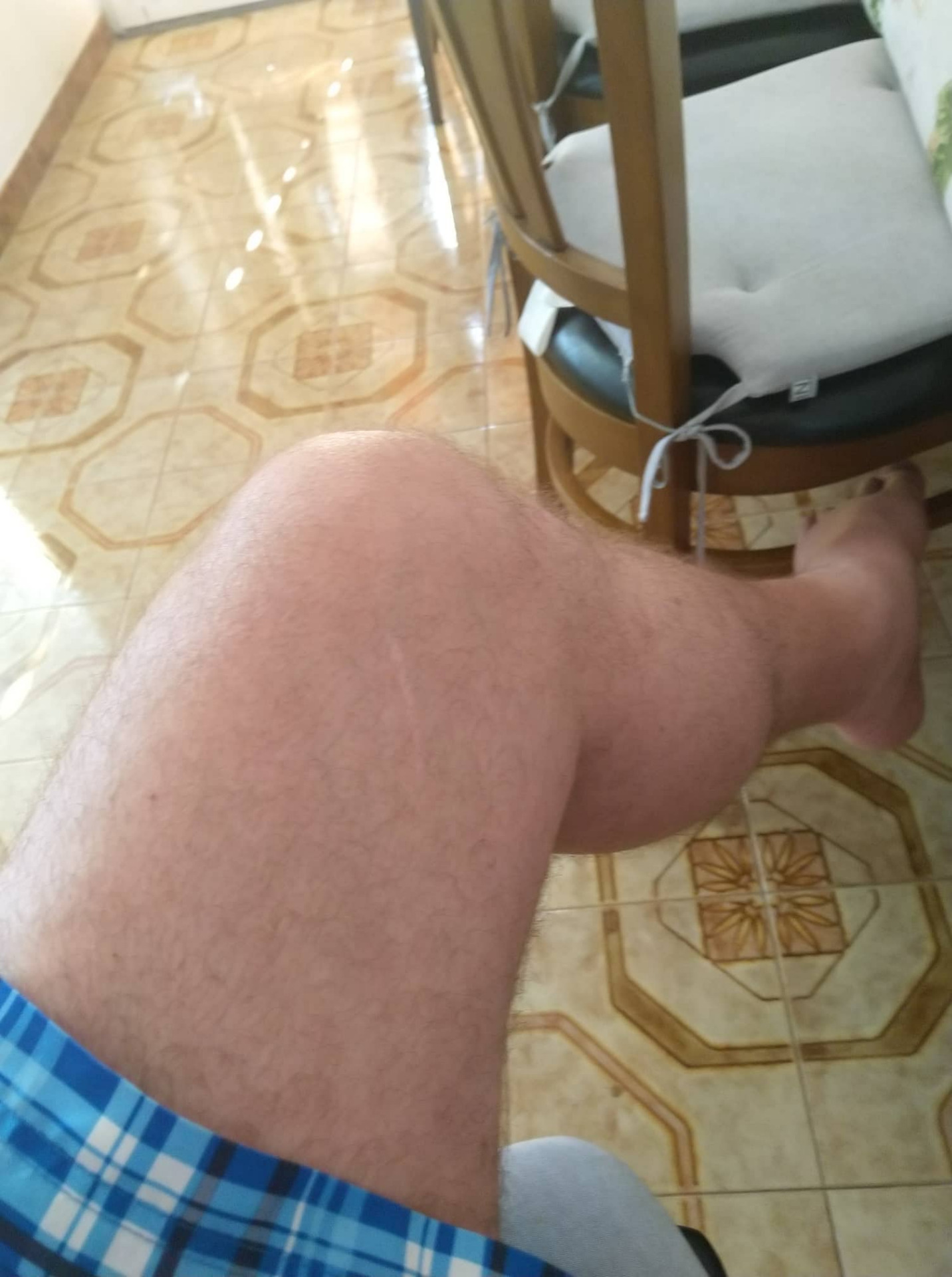 Bedagadt és mozgásképtelen térd, de rendkívül formás és kivételesen izmos vádli az indulás előtti napon